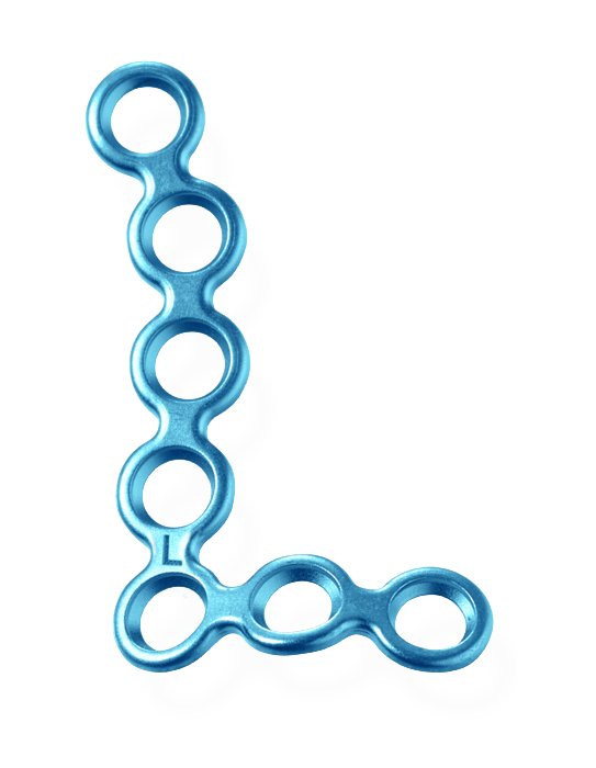 25-320-32-71 25-320-32-71  ~ Smart3D Paranasalplatte,1.5,7-L,li,T=0.6 ~