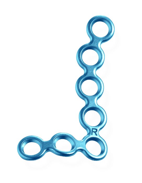 25-320-33-71 25-320-33-71  ~ Smart3D Paranasalplatte,1.5,7-L,re,T=0.6 ~