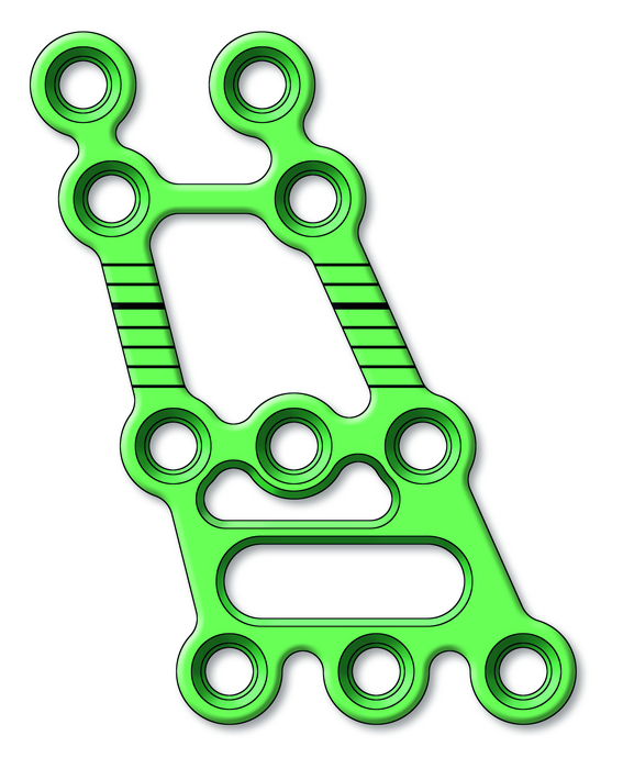 25-401-43-09 25-401-43-09  ~ Ramus Gleitplatte,2.0,10-L,re,T=1.2,M ~