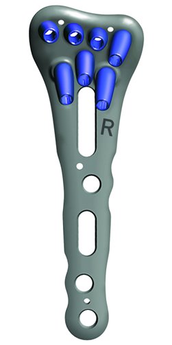 26-066-40-09 26-066-40-09  ~ RECOS RADIUS SIZER FÜR 26-166-40 ~