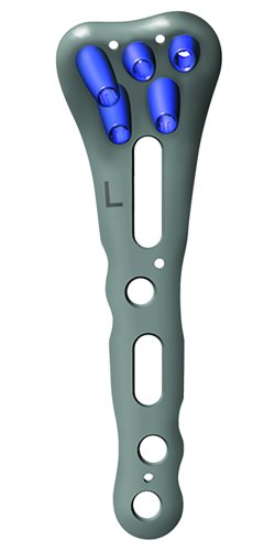 26-066-43-09 26-066-43-09  ~ RECOS RADIUS SIZER FÜR 26-166-43 ~