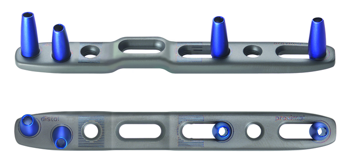 26-166-65-09 26-166-65-09  ~ RECOS Ulnaverkürzung Brücke L80 TI steri ~