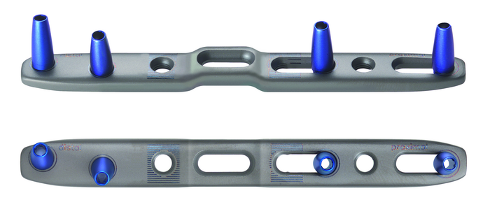 26-166-75-09 26-166-75-09  ~ RECOS Ulnaverkürzung Brücke L90 TI steri ~