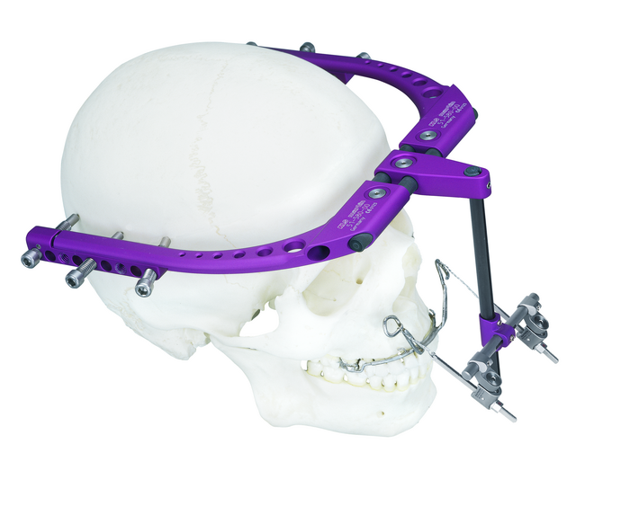 51-580-02-04 51-580-02-04  ~ POLLEY II RAHMEN, RECHTS, KOMPLETT ~