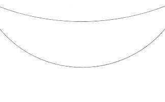 15-452-03-07  ~ WUNDHAKEN, FRITSCH, 45X63 MM, 25 CM ~