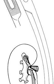 31-101-23-07  ~ NIERENSTEINZANGE, RANDALL, FIG. 1, 23 CM ~