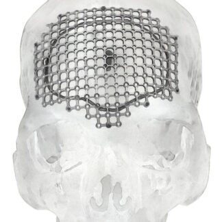 25-007-01-09  ~ MESH FUER BIFRONTALEN ZUGANG ~