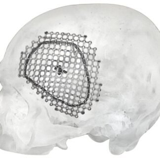 25-007-02-09  ~ MESH FUER PTERIONALEN ZUGANG, LINKS ~