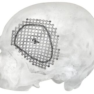 25-007-02-71  ~ MESH FUER PTERIONALEN ZUGANG, LINKS, ST. ~