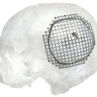 25-007-04-09  ~ MESH FUER PARIETALEN ZUGANG, LINKS ~