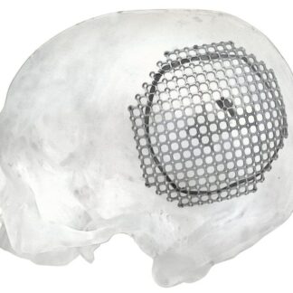 25-007-04-71  ~ MESH FUER PARIETALEN ZUGANG, LINKS, ST. ~