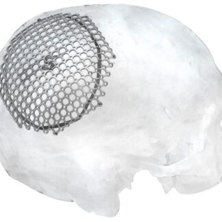 25-007-05-71  ~ MESH FUER PARIETALEN ZUGANG, RECHTS, ST. ~