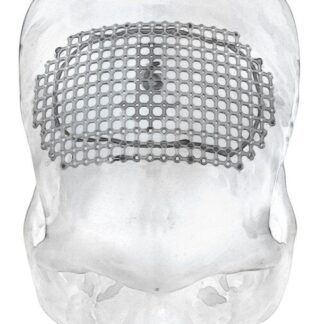 25-007-06-09  ~ MESH F. ANTERIOREN PARASAGITTALEN ZUGANG ~