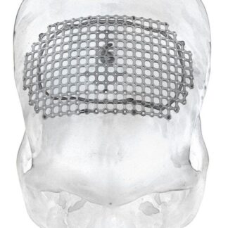 25-007-06-71  ~ MESH F. ANTER. PARASAGITTALEN ZUGANG ST. ~