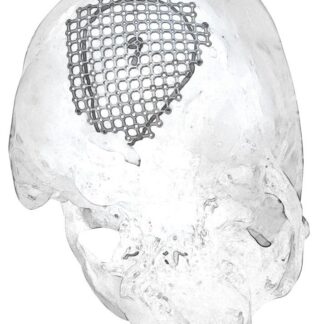 25-007-09-09  ~ MESH FUER SUBOCCIPITALEN ZUGANG, RECHTS ~