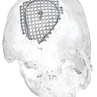 25-007-09-71  ~ MESH F. SUBOCCIPITALEN ZUGANG, RE., ST. ~