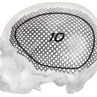 25-007-10-09  ~ MESH F. FRONTOTEMPOROPAR. ZUGANG, LI ~