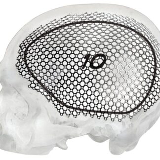 25-007-10-71  ~ MESH F. FRONTOTEMPOROPAR. ZUGANG, LI, ST ~