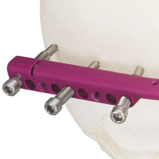 51-575-12-09  ~ TITANIUM SCHRAUBEN 55 MM  10 PCK ~