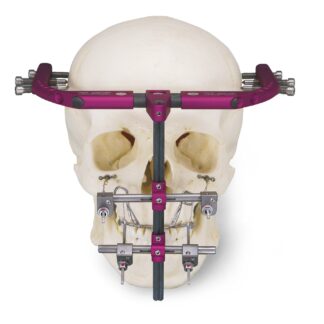 51-580-00-04  ~ POLLEY MITTELGESICHT DISTRAKTIONS SYST. ~
