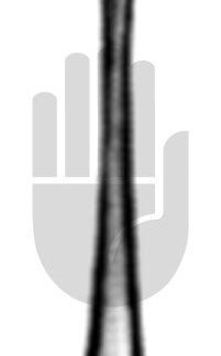 HB7256  ~ Fremdkörpernadel, gerade, 12cm ~