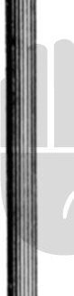 HB7287  ~ Wilder Tränenkanal-Dilatator, Fig.1, 10cm ~
