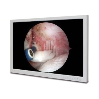 HL9221-20  ~ Hi-Class-Med - ENDOSCOPY    Medizinischer Monitor,  21,5", HD ~