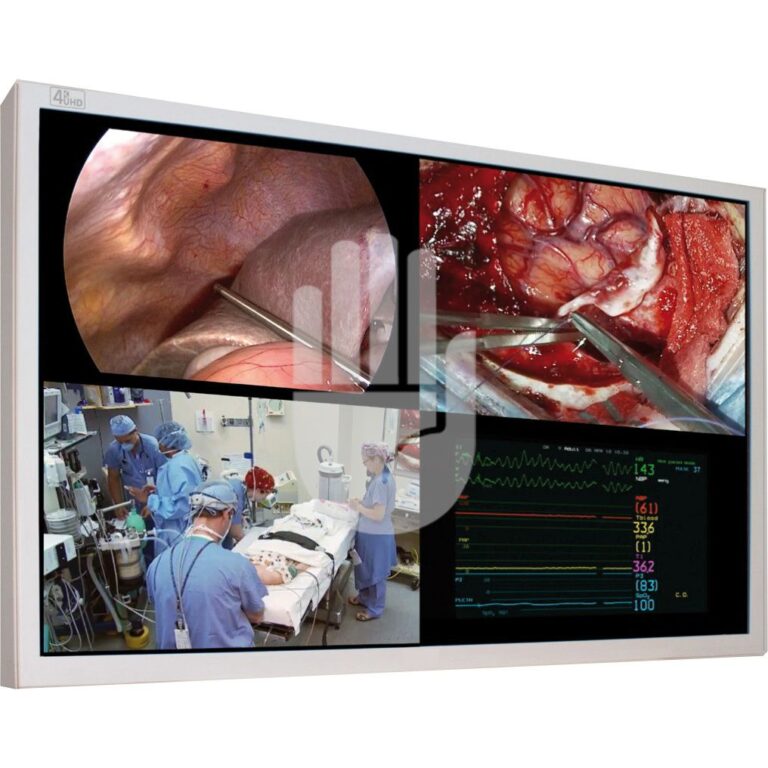 HL9255-40 HL9255-40  ~ Hi-Class-Med - ENDOSCOPY    Medizinischer Monitor, 55", 4K UHD ~