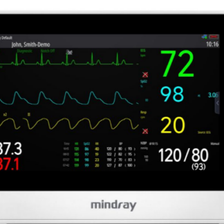 M3K6B-XA0000  ~ uMEC 100 kompakter Patientenmonitor ~